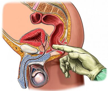 Digital prostate test
