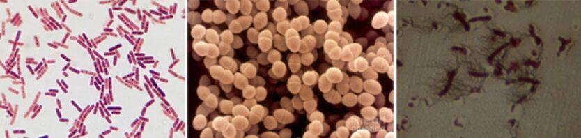 Escherichia coli, stool enterococcus and proteus are the main causal agents of chronic bacteria