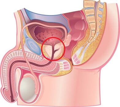 The location of a prostate in men