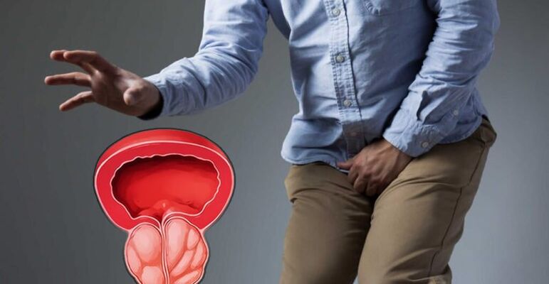 Preventing prostatitis and prostate adenoma